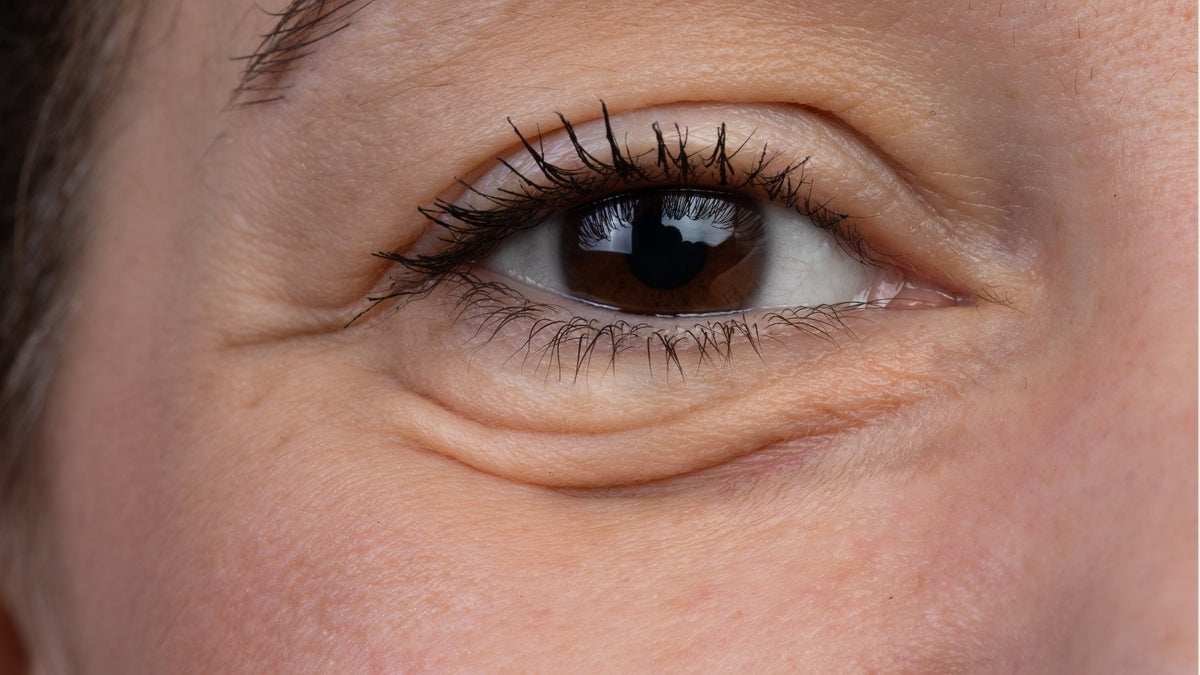 Botanical Eye Lift silmänympärysseerumi — Soil of Beauty