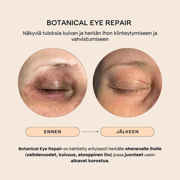 BOTANICAL EYE REPAIR Ravitseva & juonteita silottava silmänympärysseerumi
