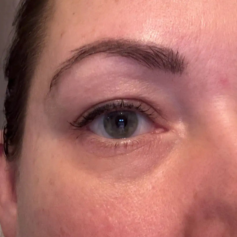 Silmäpussit poissa Botanical Eye Liftin säännöllisellä käytöllä — kirkkaampi ja kiinteämpi silmänympärysiho