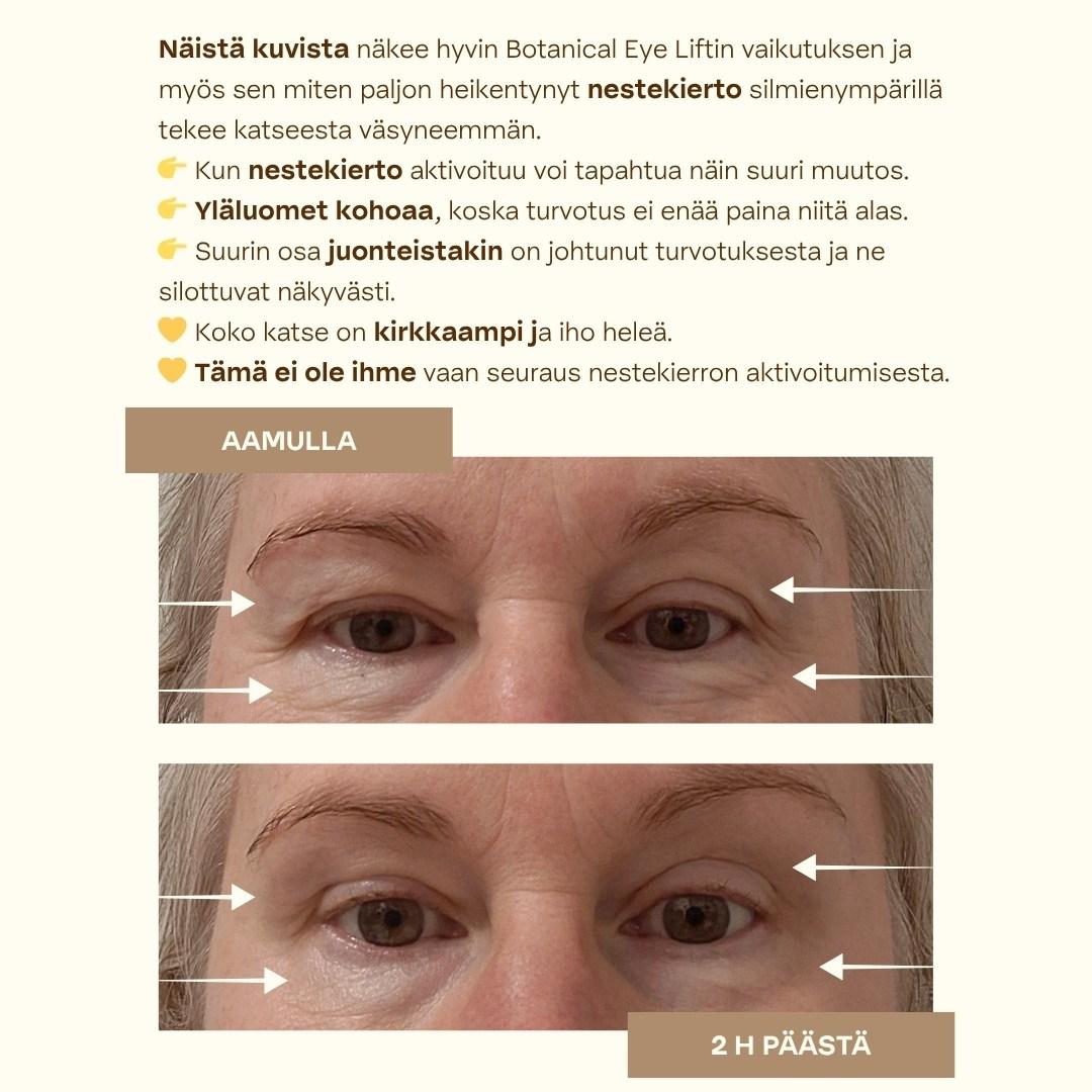 Botanical Eye Lift asiakkaan tulokset