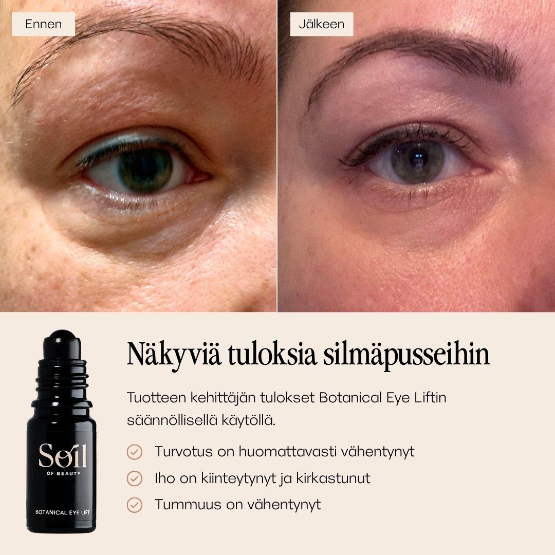 Botanical Eye Lift silmänympärysseerumi. Ennen ja jälkeen kuvat. 