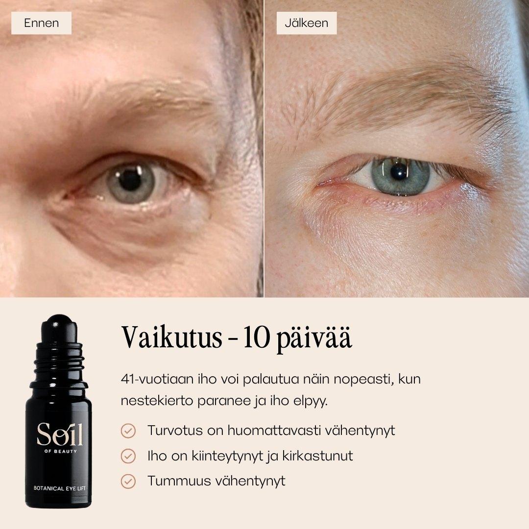 Botanical Eye Lift silmänympärysseerumi. Ennen ja jälkeen kuvat. 