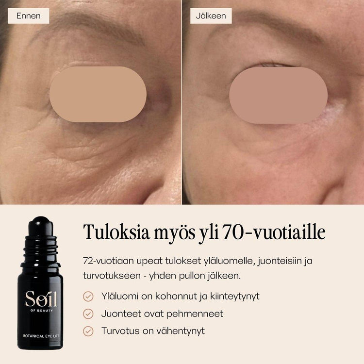 Botanical Eye Lift silmänympärysseerumi. Ennen ja jälkeen kuvat. 