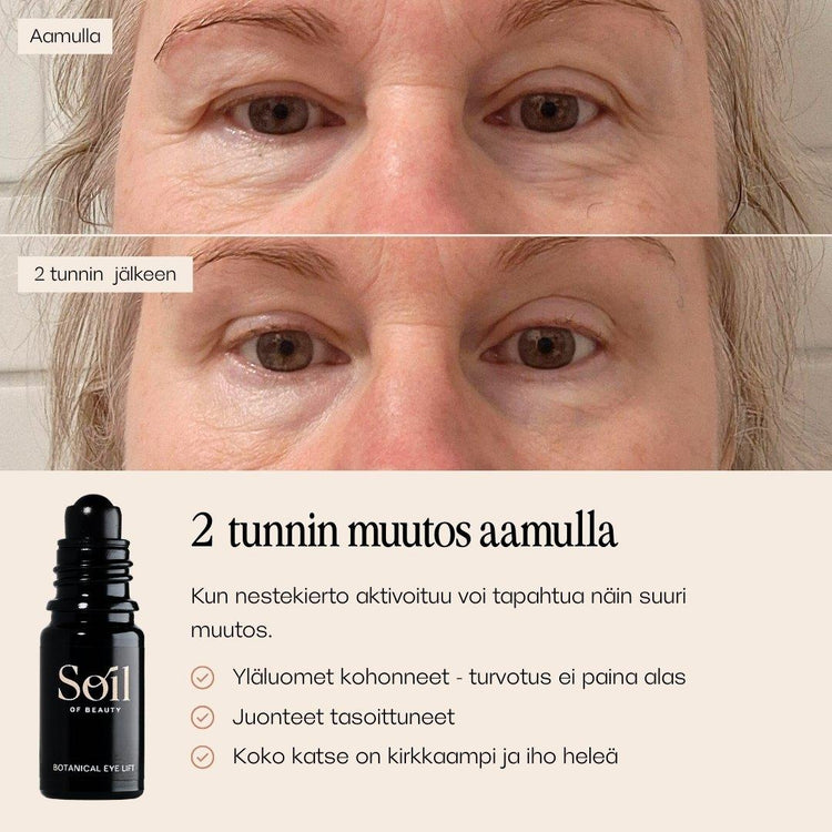 Botanical Eye Lift silmänympärysseerumi. Ennen ja jälkeen kuvat. 
